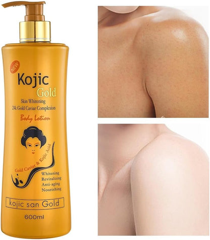 Kojic Acid Soap Skin Whitening 24 Gold Caviar Complexion Lotion,