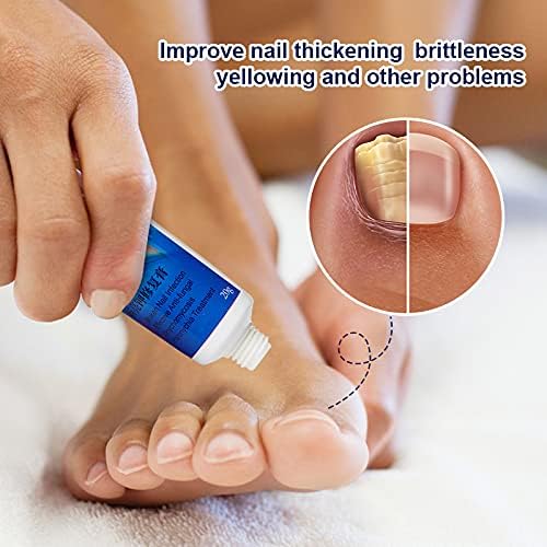 SUMIFUN Nail Fungus Treatment Cream