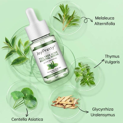 JoyPretty Tea Tree Acne Removal/ Treatment Serum (30 ml)