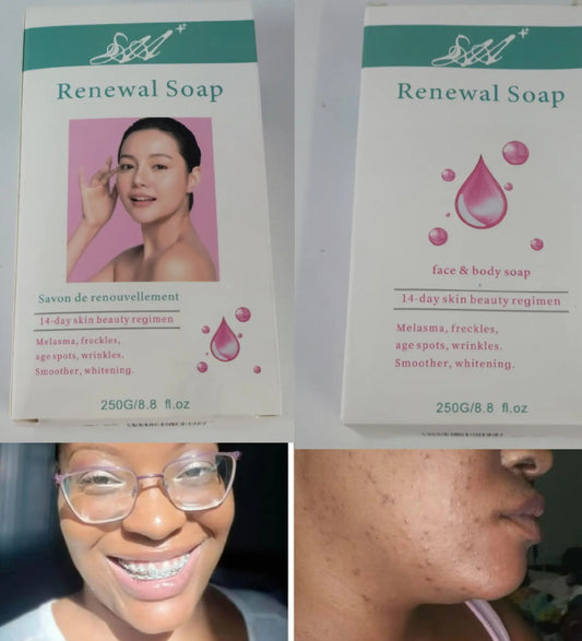 Renewal Soap for Face & Body