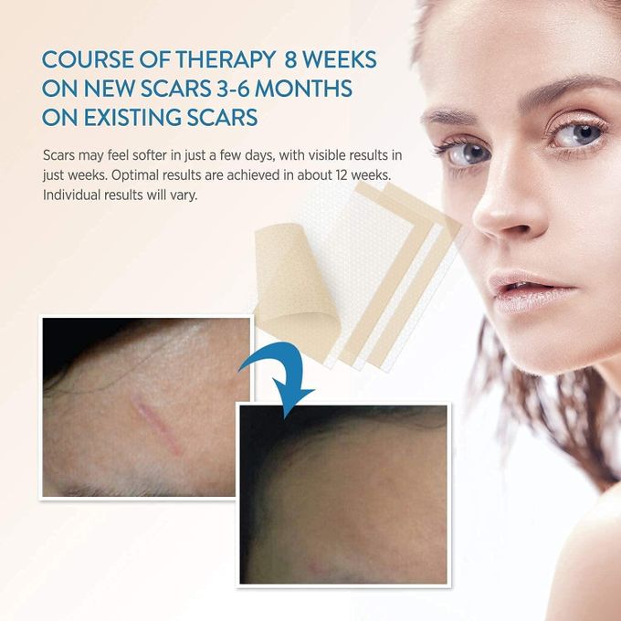 Aroamas Scar Removal Sheets – Professional Silicone Scar Treatment (8 Sheets | 4-Month Supply)