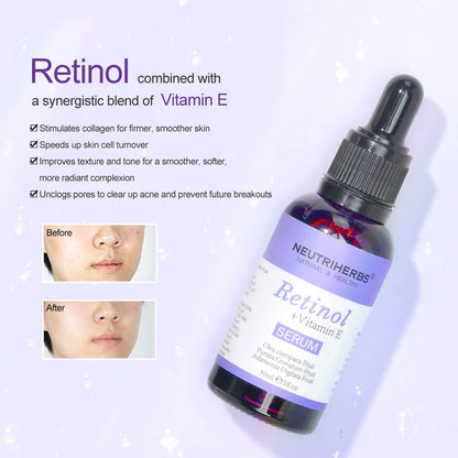 Neutriherbs Retinol Face Serum
