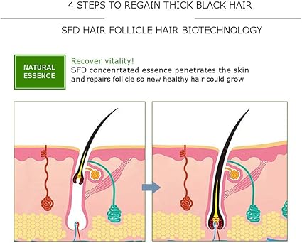 Disaar Hair Growth In Baldness Essential Oil For Anti Hair Loss-30g