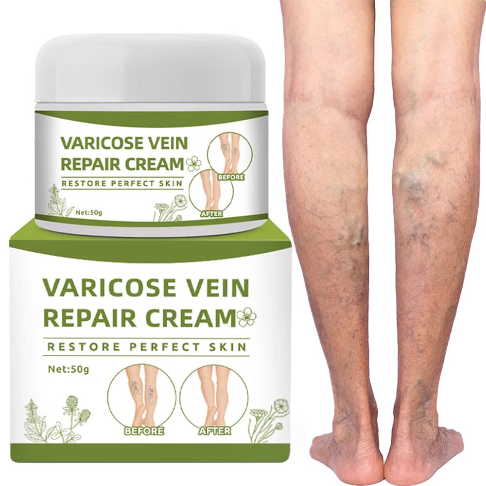Elaimei Varicose Veins Cream