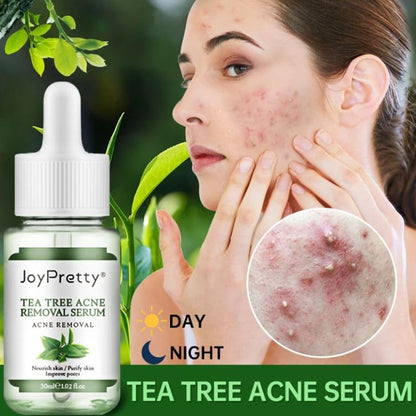 JoyPretty Tea Tree Acne Removal/ Treatment Serum (30 ml)