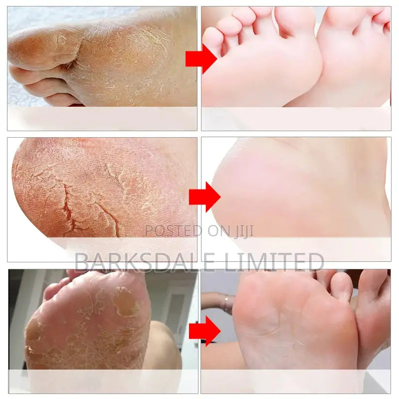 SADOER Exfoliating Foot Mask