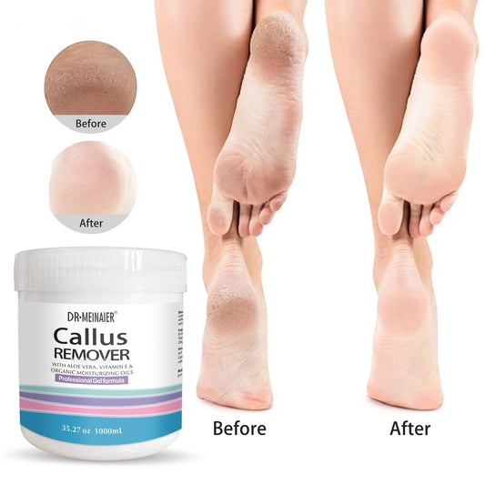 Dr. Meinaier Callus Remover