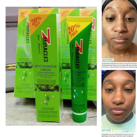 7 Miracles Spot Remover Cream