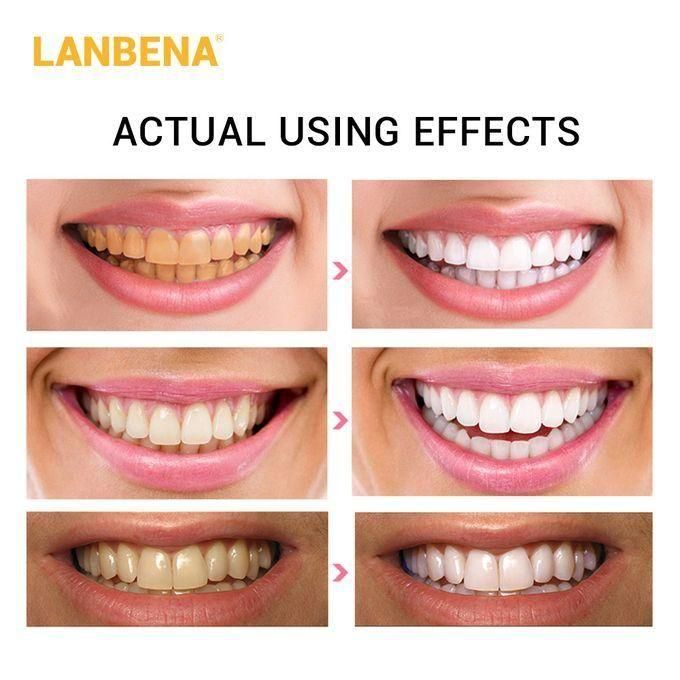 LANBENA Teeth Whitening Strips with Bamboo Charcoal