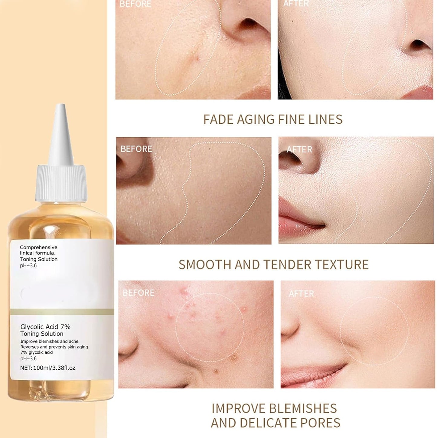 ENVISHA Face Skin Care 100ML Glycolic Acid 7% Toning Solution To Remove Acne And Moisturizing Skin Rejuvenating Deep Hydration