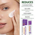 Sauvasine Azelaic Acid 12% Facial Cream with Hyaluronic Acid & Niacinamide – Fade Dark Spots, Acne & Redness B