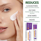 Sauvasine Azelaic Acid 12% Facial Cream with Hyaluronic Acid & Niacinamide – Fade Dark Spots, Acne & Redness