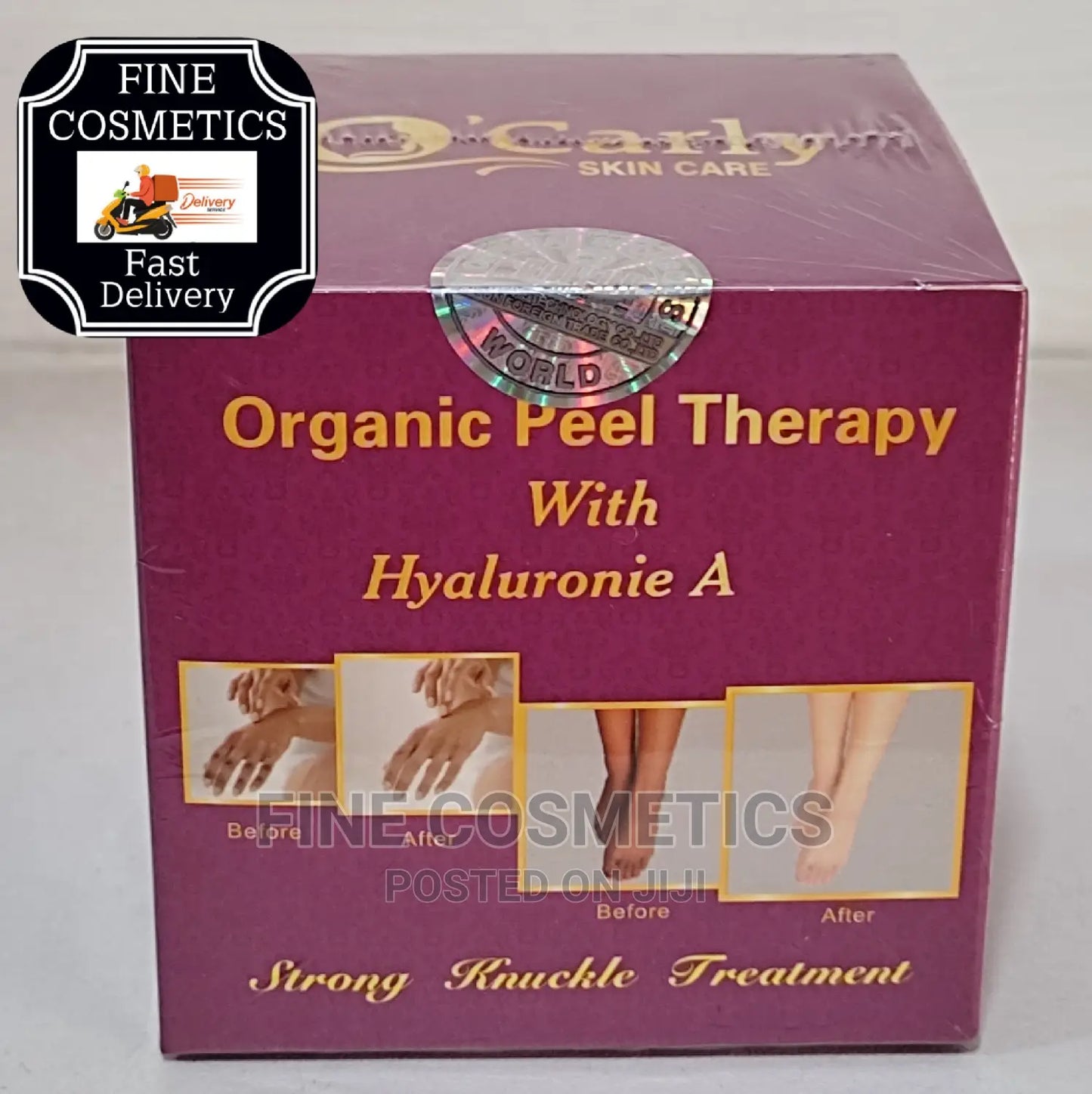 O’CARLY Strong Whitening Knuckle Remover Night Cream – 30g