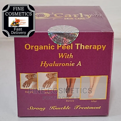 O’CARLY Strong Whitening Knuckle Remover Night Cream – 30g
