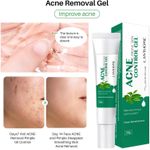 Lanthome Acne Control Gel - 20g