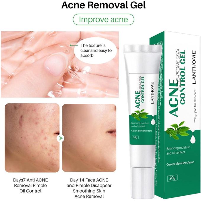 Lanthome Acne Control Gel - 20g