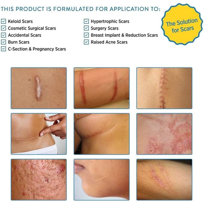Aroamas Scar Removal Sheets – Professional Silicone Scar Treatment (8 Sheets | 4-Month Supply)