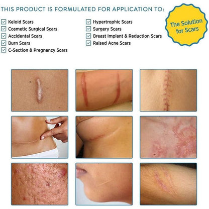 Aroamas Scar Removal Sheets – Professional Silicone Scar Treatment (8 Sheets | 4-Month Supply)