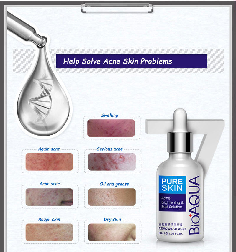 BIOAQUA Acne Removal & Acne Serum Solution