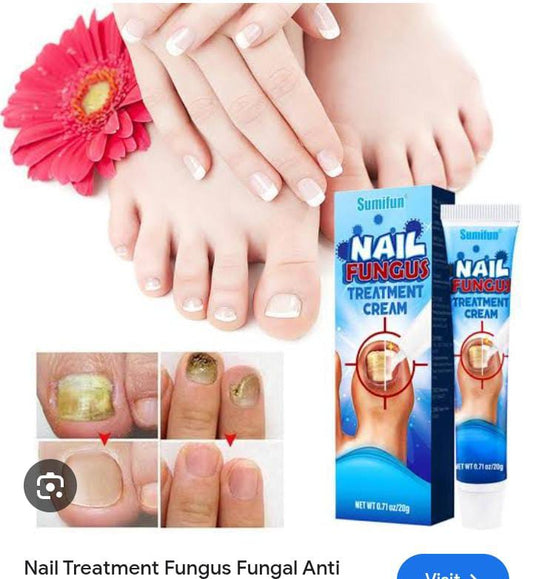 SUMIFUN Nail Fungus Treatment Cream