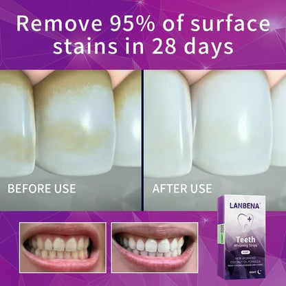 LANBENA Teeth Whitening Strips