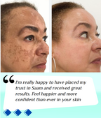 🔥ORIGINAL Saam Renewal Face Cream with QR CODE , BUY 1 GET 1 EXTRA FREE 🔥