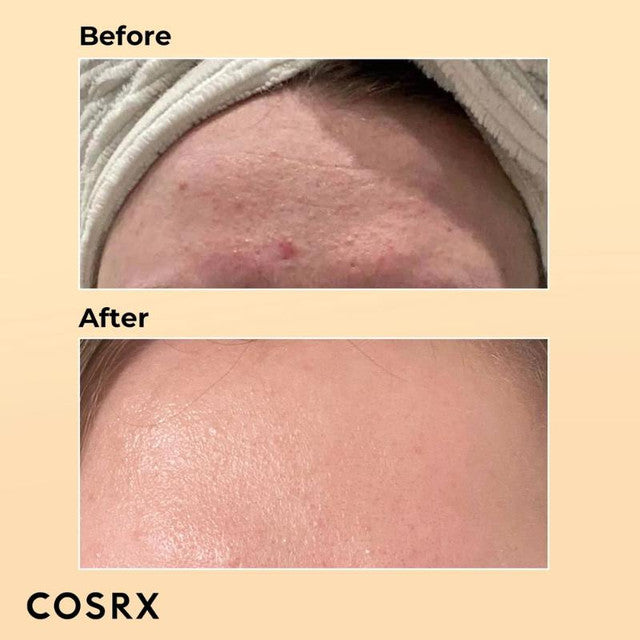 Cosrx Advanced Snail Mucin 96 Power Essence