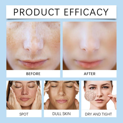 OUHOE Dark Spot Corrector Serum