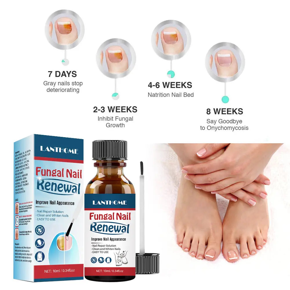 Lanthome Fungal Nail Renewal Repair Essence Liquid