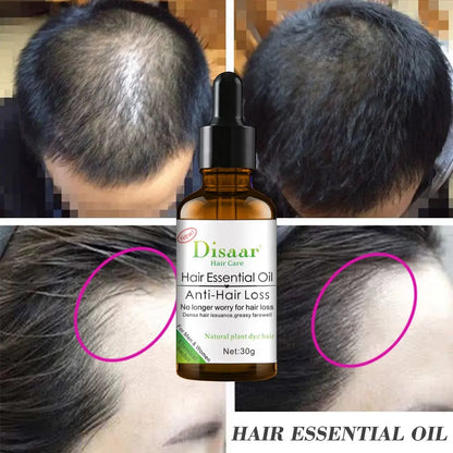 Disaar Anti-Hair Loss Essential Oil