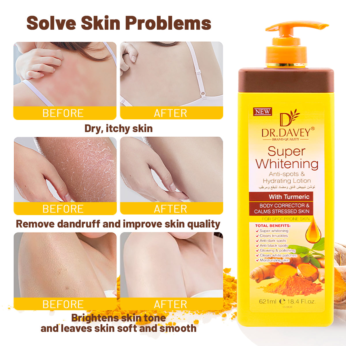 Dr. Davey Super Whitening Anti-Spots & Hydration Lotion with Turmeric