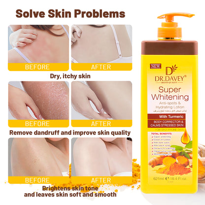 Dr. Davey Super Whitening Anti-Spots & Hydration Lotion with Turmeric