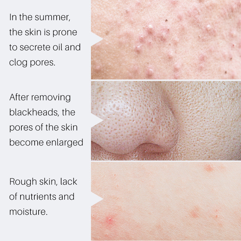 SAUVASINE Pore Control Serum