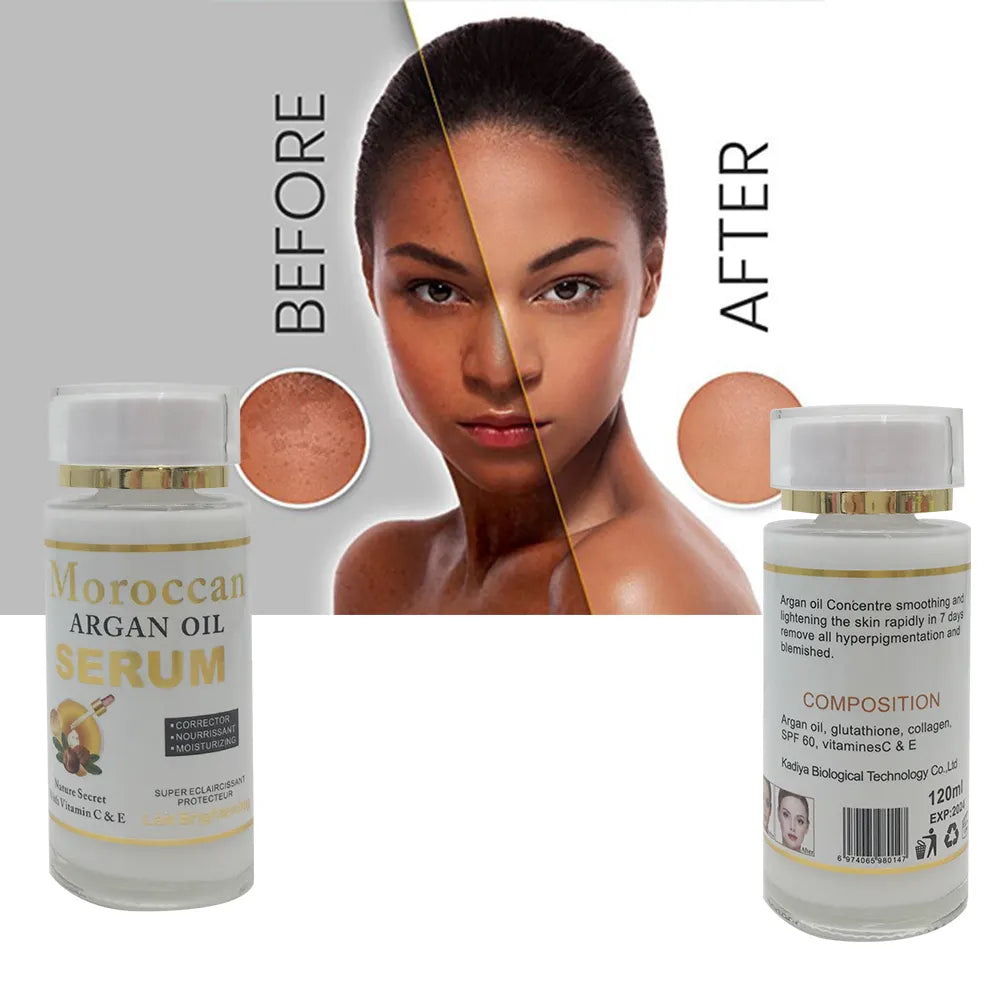 Moroccan Argan Oil Serum (With - Vitamin - C & E) 120ml