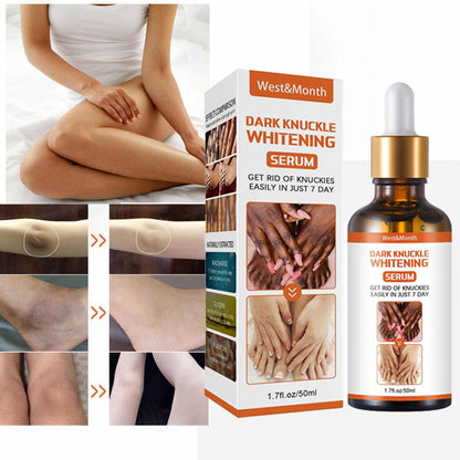 Skin Care Serum Vitamin C Brightening Whitening Skin Lifting Skin Care Serum Niainamide for Anti Aging Vitamin c Serum knucles, elbow, knees