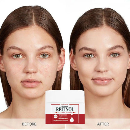Lanthome Collagen & Retinol Face Wrinkle Remover Cream