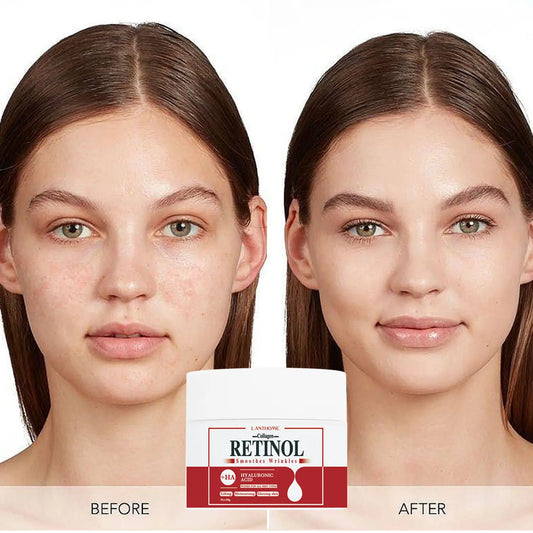 Lanthome Collagen & Retinol Face Wrinkle Remover Cream