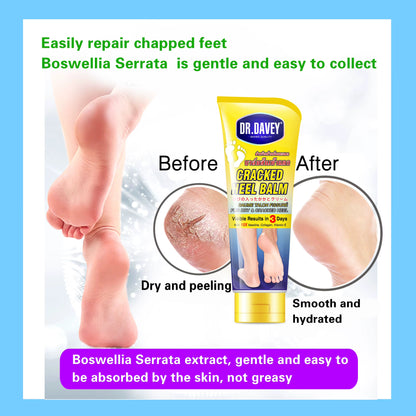 Dr. Davey Cracked Heel Balm Foot Care Cream