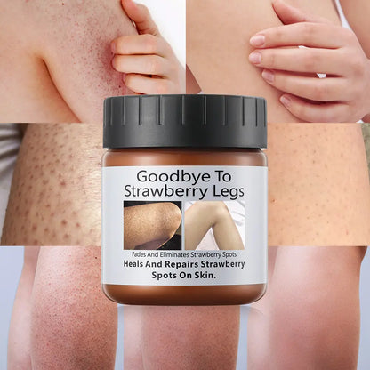 MOOYAM Dark Knees and Elbows Strong Whitening Cream (120g)