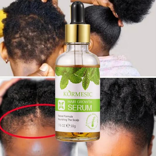 KORMESIC Hair Growth Serum – 50g