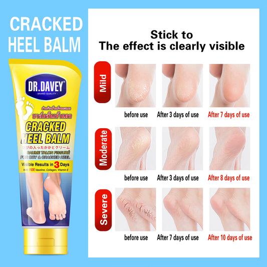 Dr. Davey Cracked Heel Balm Foot Care Cream