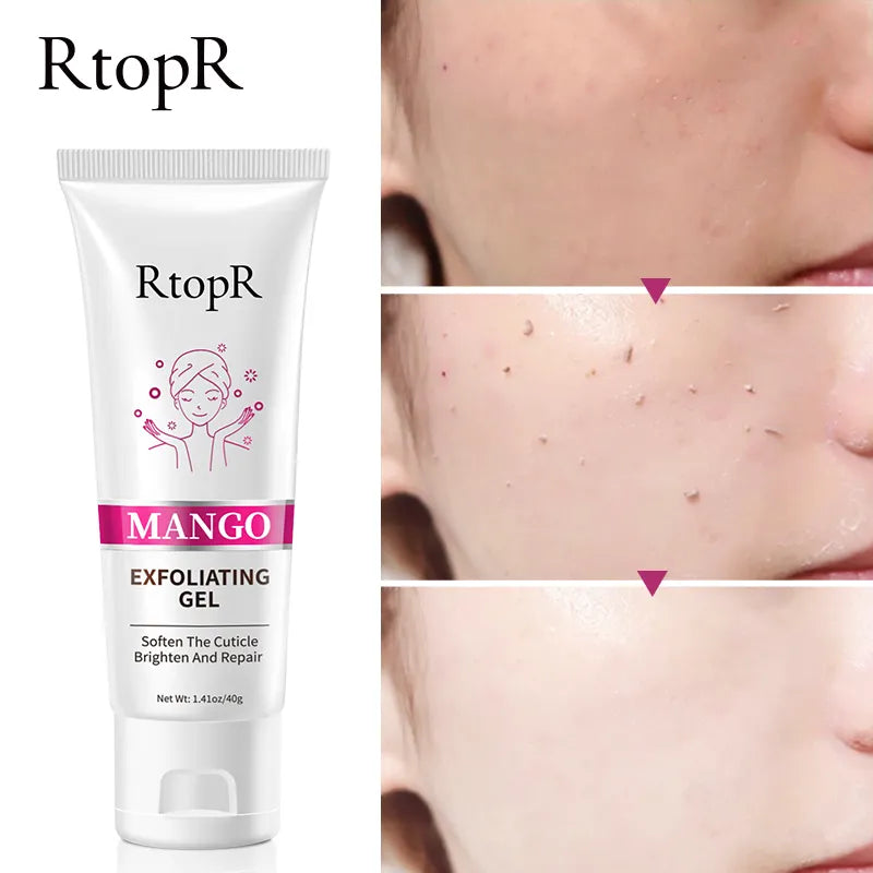 RtopR Mango Exfoliating Gel