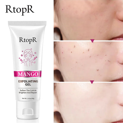 RtopR Mango Exfoliating Gel
