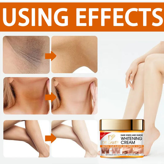 Dr. Davey Dark Knees and Elbows Whitening Cream (350ml)