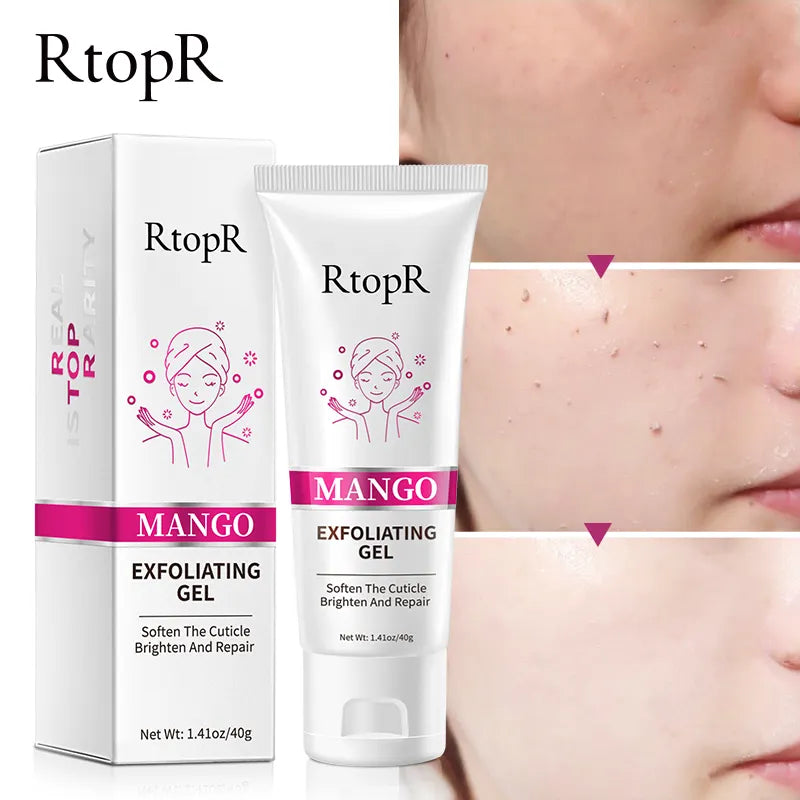 RtopR Mango Exfoliating Gel