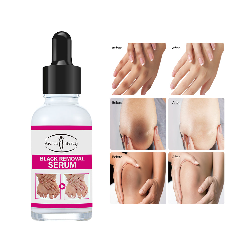 Aichun Beauty Black Removal Serum