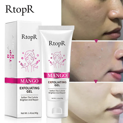 RtopR Mango Exfoliating Gel