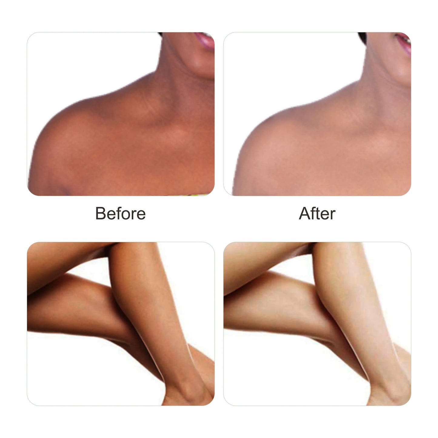 Cindella Vitamin C Whitening Lotion