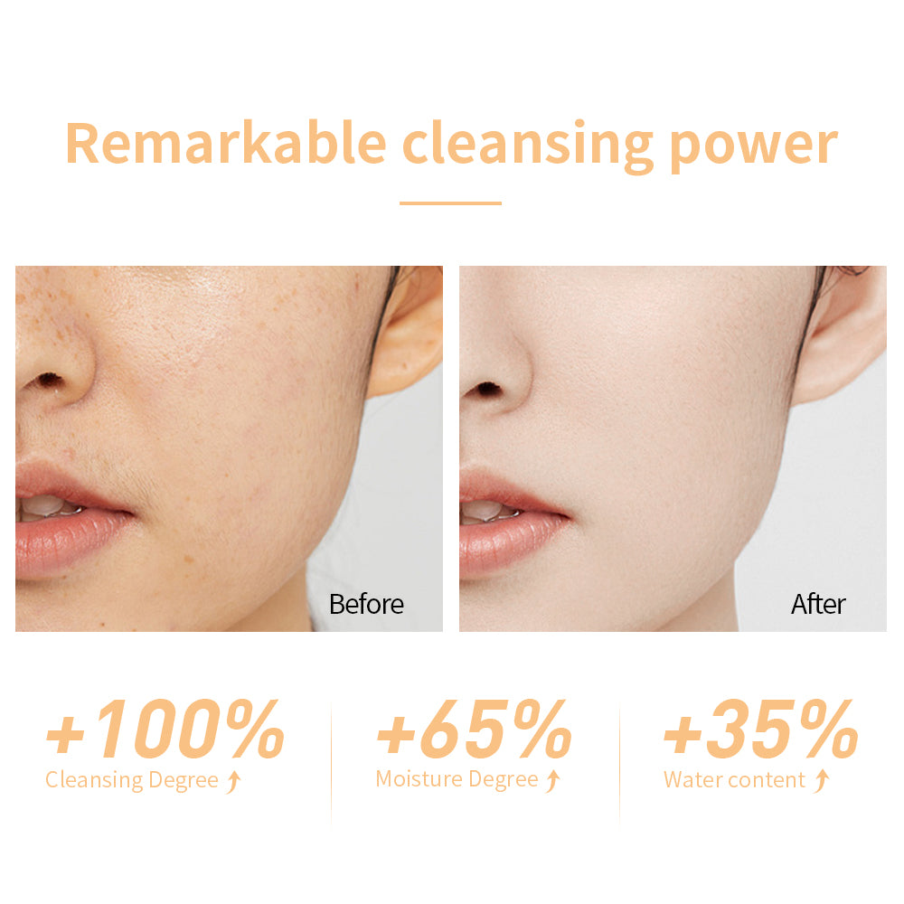 LANBENA Niacinamide Foaming Cleanser