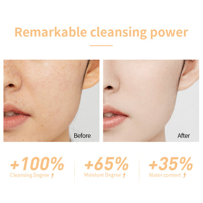 LANBENA Niacinamide Foaming Cleanser
